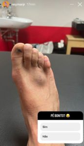 Foto_lesão_Neymar_Revista_Comunhão