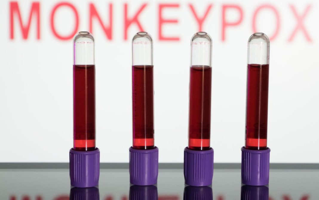 Ministério da Saúde amplia testagem de varíola dos macacos - Foto: Nikos Pekiaridis/NurPhoto/Direitos reservados