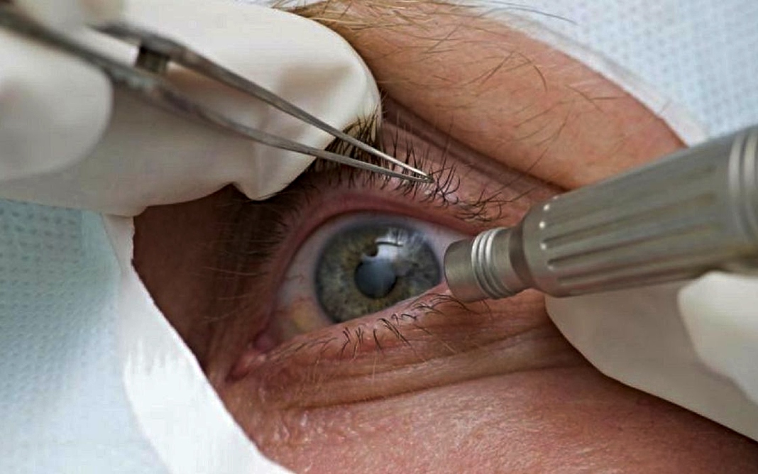 Entidades médicas cobram regras sanitárias em mutirões de cirurgias - Foto: © Pref de Três Barras SC/Divulgação/Direitos Reservados